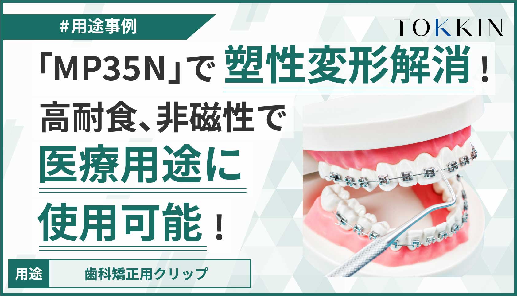 Ni-Co-Cr-Mo合金「MP35N」で塑性変形解消！高耐食、非磁性だから医療用途に使用可能！